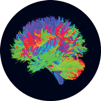 Brain1