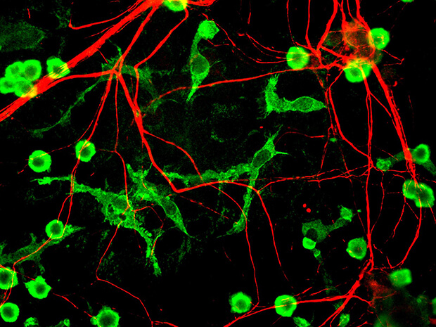Microglia